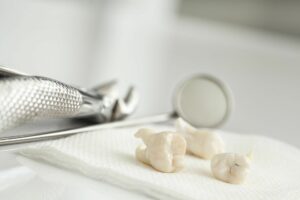 tooth extraction